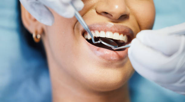 Best Emergency Dentist for Lost Fillings or Crowns in North Sea, NY